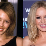 Has Kylie Minogue had Plastic Surgery